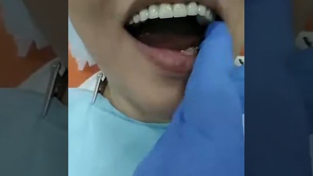 КЕРАМИКА ТИШЛАР ! МОСКВА +79636579707 ВАТСАП