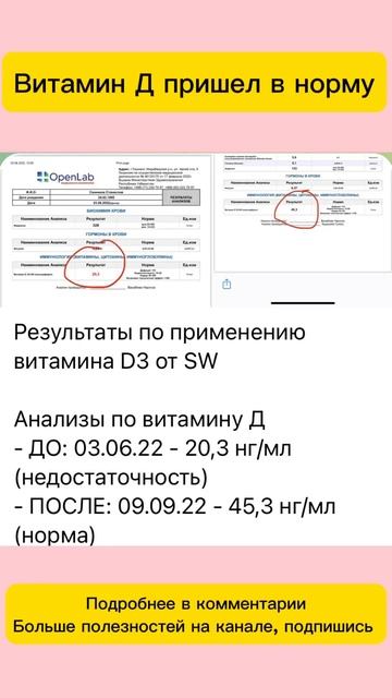 Недостаток витамина д, дефицит витамина д #сибирскоез?