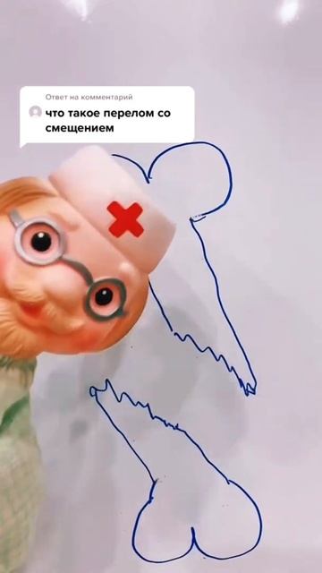 Что такое перелом со смещением? 👨🏻⚕️ #shorts