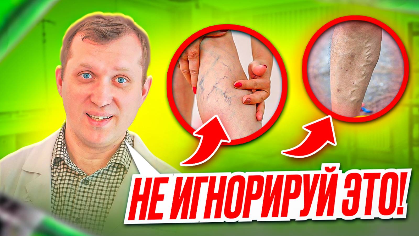 Как правильно ЛЕЧИТЬ ВАРИКОЗ? Честный ответ ФЛЕБОЛОГА!