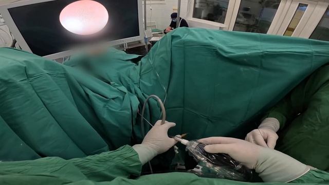 Удаление камня мочеточника без разрезов.  Вид от перво