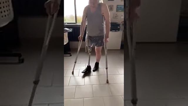 Протезирование конечностей 