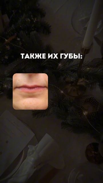 Филлер в губы- это необходимость