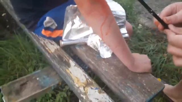 Советы для тех кто упал как л*х с горки(ну или не совсем