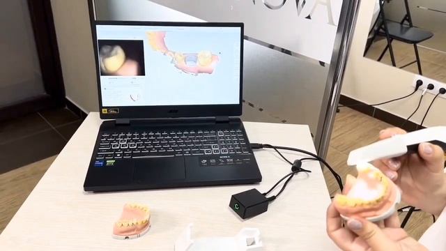 ОБЗОР ИНТРАОРАЛЬНОГО СКАНЕРА PANDA P3 МЕГА КРУТОЙ КИТАЙС?