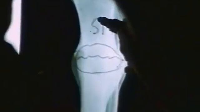 кремний - основа здоровья .mp4