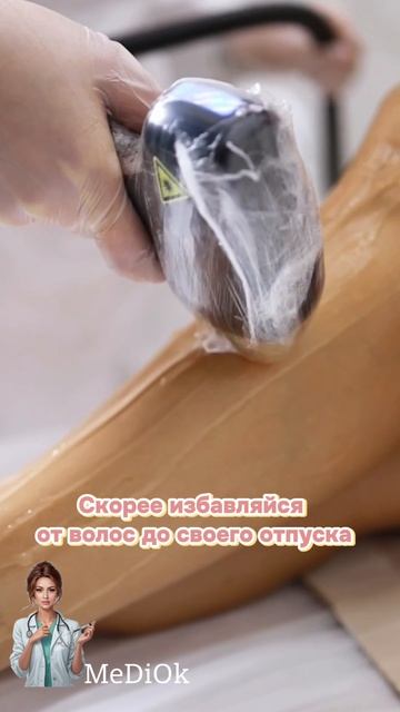 Лазерная эпиляция