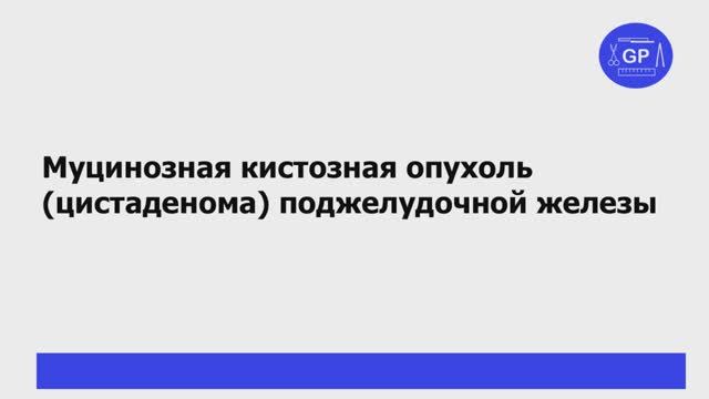Муцинозная кистозная опухоль (цистаденома) поджелудочной железы