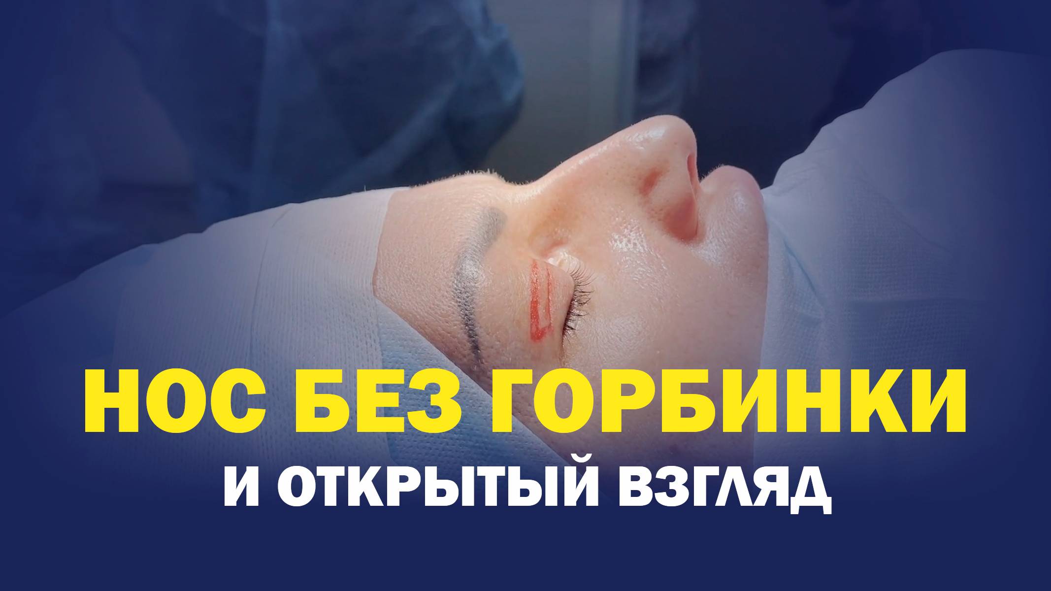 Гармония вместо горбинки: естественный результат от доктора Иванова