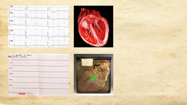 Первая в мире ЭКГ.  Вклад Уоллера, собачки Джимми и основы электрофизиологии