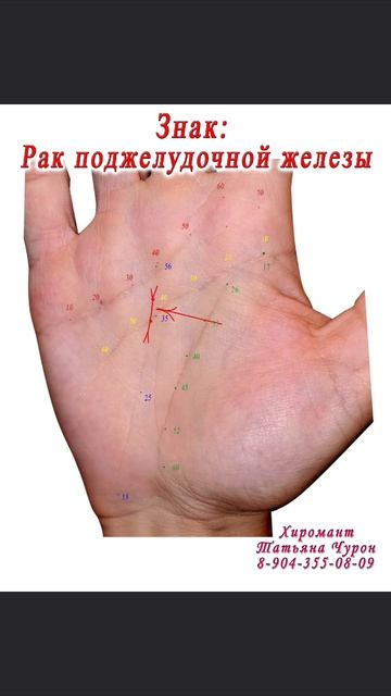 Знак. Хиромантия. Здоровье.
#обучение #fyp #хиромантия