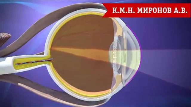 Астигматизм глаза. Причины, виды астигматизма.