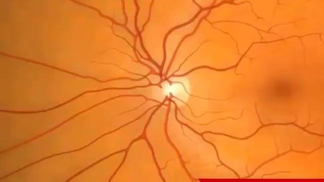 Строение глаза