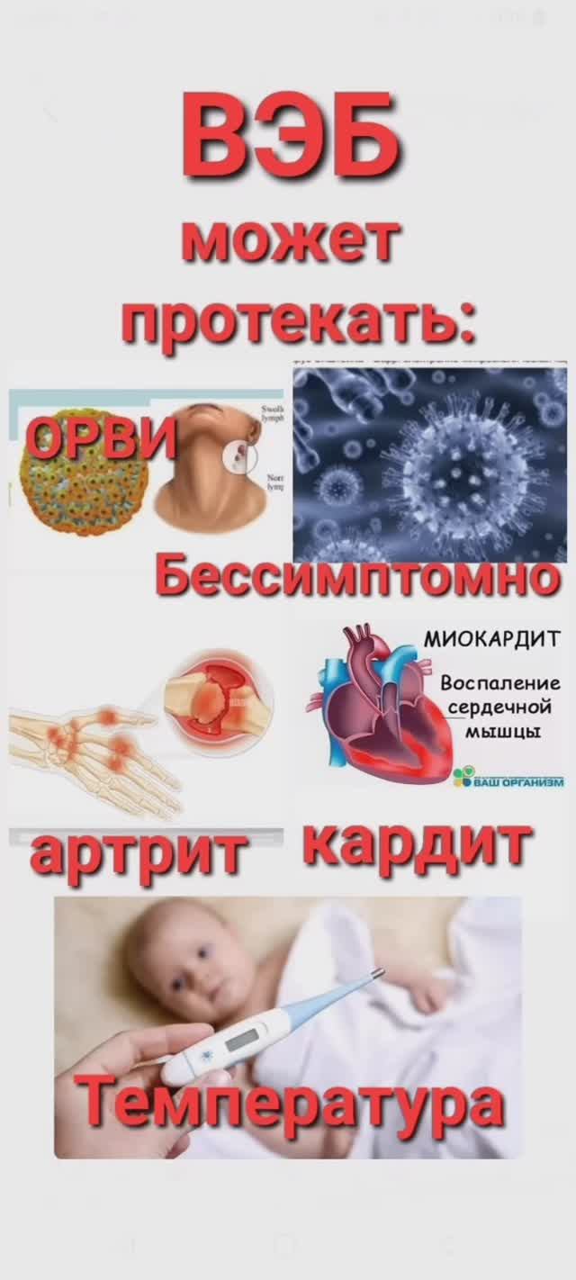 ВЭБ (вирус Эпштейн- Бара)- это опасно? Клиника. Что делать?