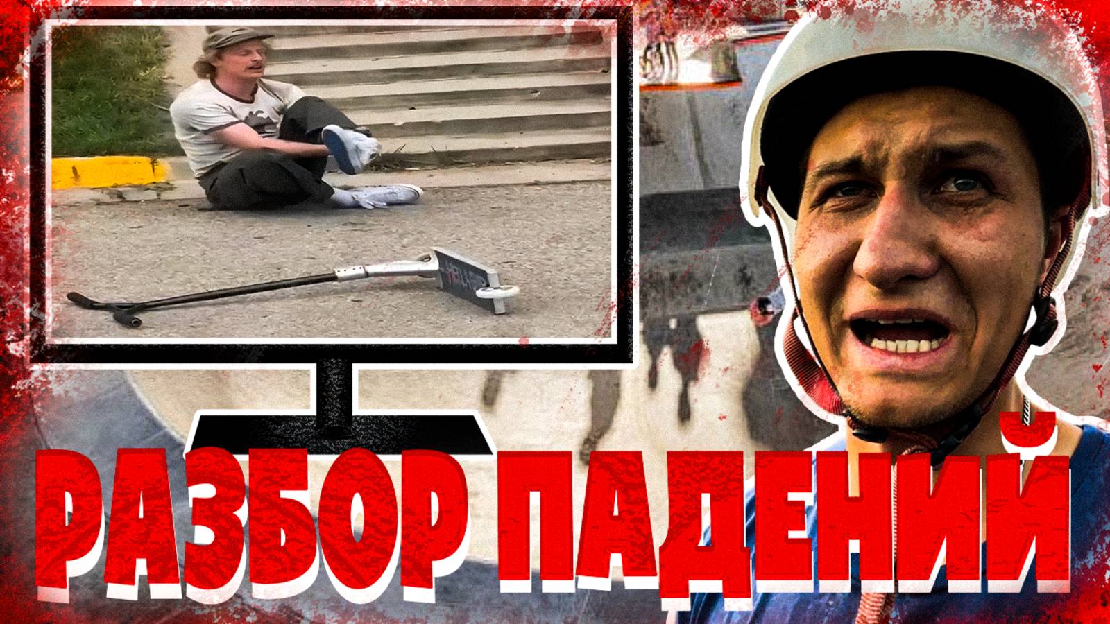 Разбор ЖЕСТИ: падения и ошибки на трюковом самокате !!!