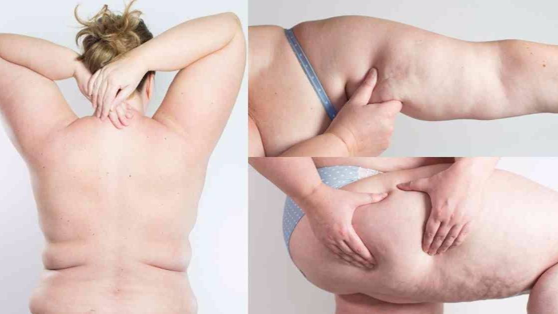 Тибетский точечный массаж от профи