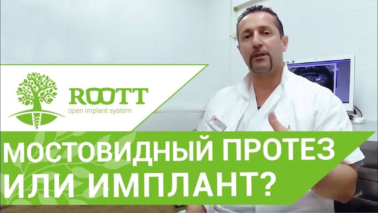 Имплант или мостовидный протез. Что выбрать мостовидный протез  ИЛИ ИМплант?