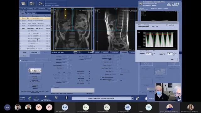 SIGNA™ Masters 2021 Live Scanning Series Body Imaging Using AIR™ Coils On SIGNA™ Voyager