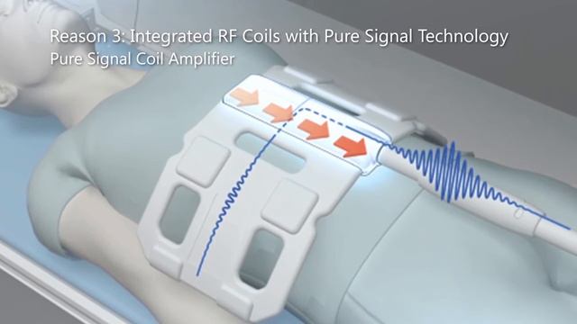 RSNA 2016 Vantage Elan 1.5T