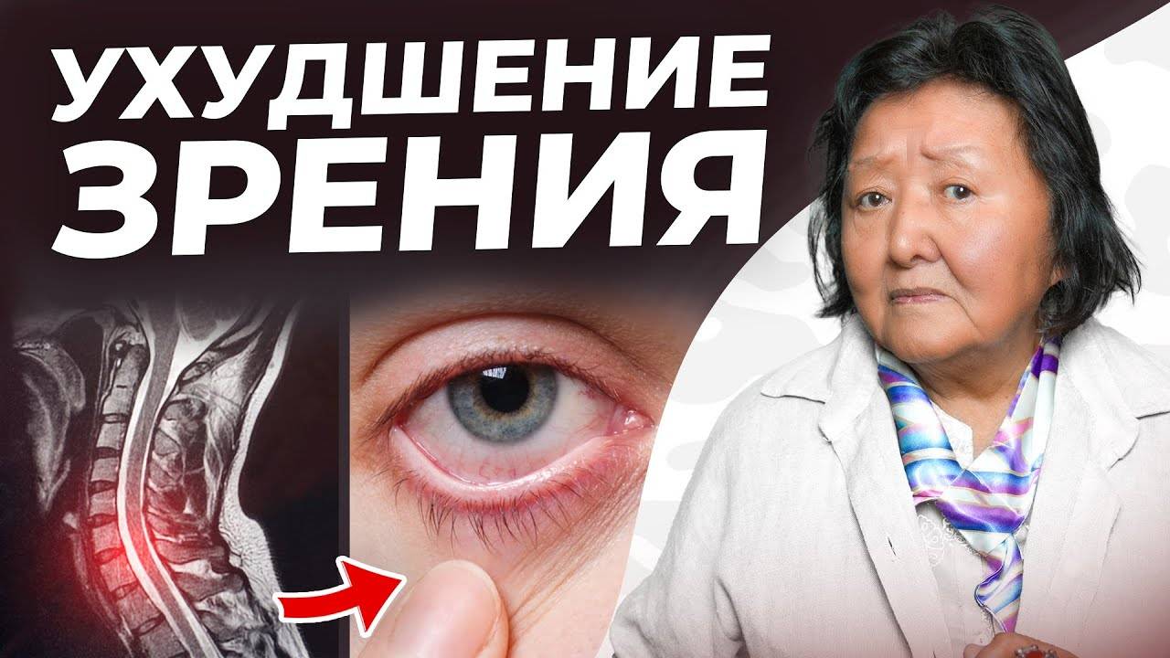 Главные причины ухудшения зрения — и УПРАЖНЕНИЯ для восстановления