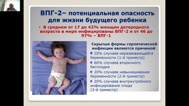 Герпесвирусная инфекция I-III типов лекция