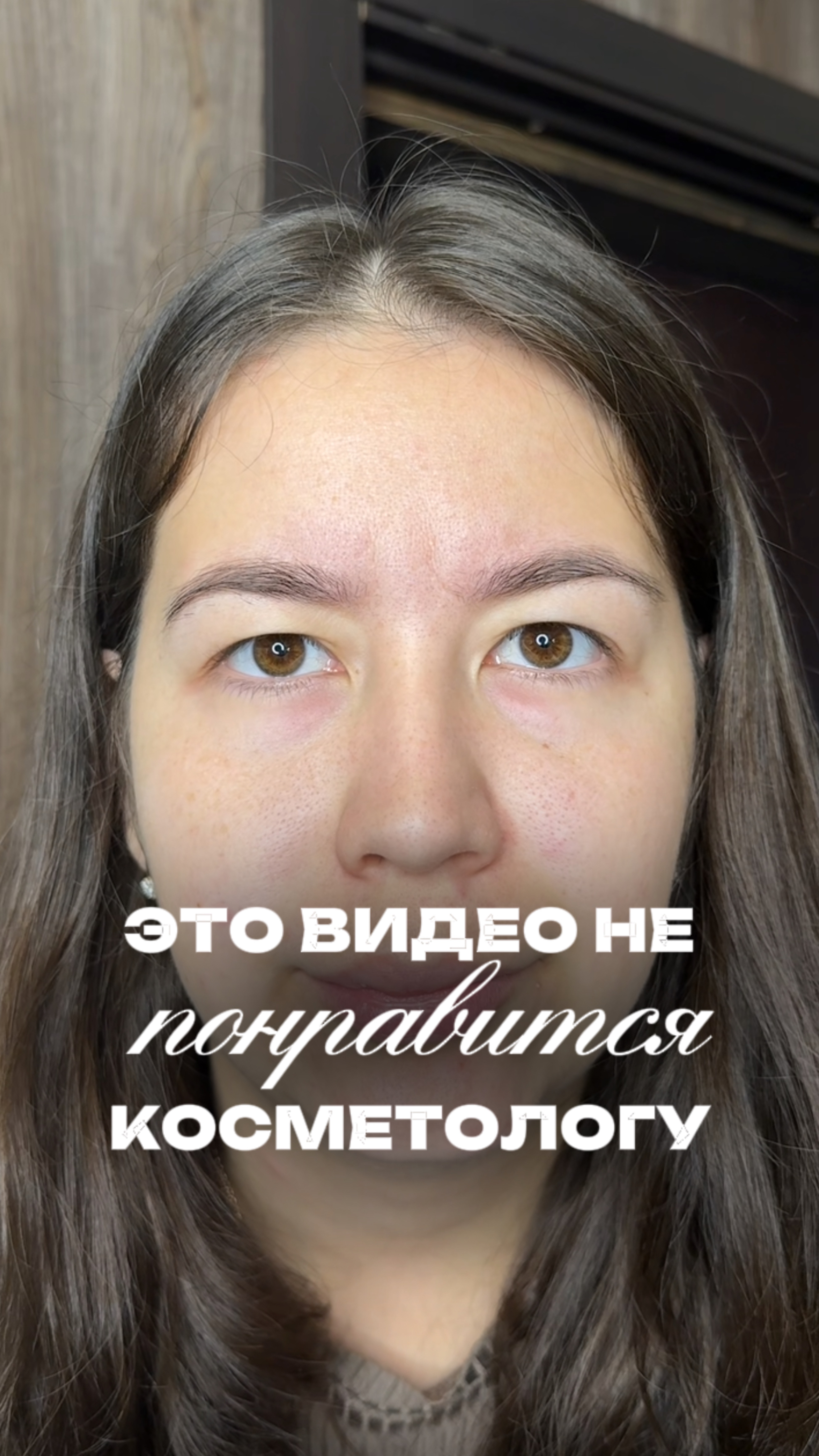 У вас есть морщины?