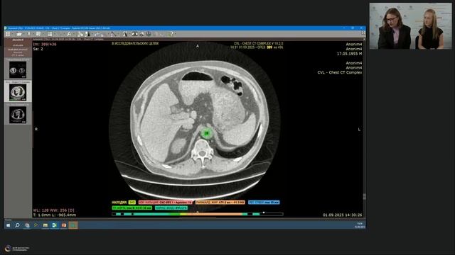 МосМедИИ: от теории к практике - компьютерная томография