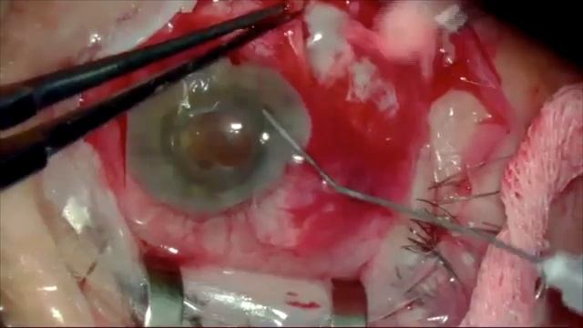 1bcaa650527d331992bc9ed0b1bdc221