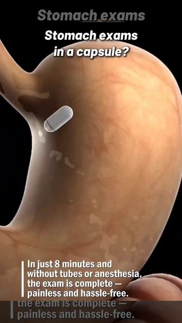 Гастроскопия с помощью капсулы-робота в Китае