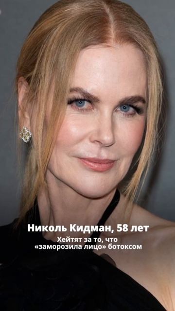 Каждую женщину будут обсуждать -за естественность, за пластику, за возраст, за молодость.