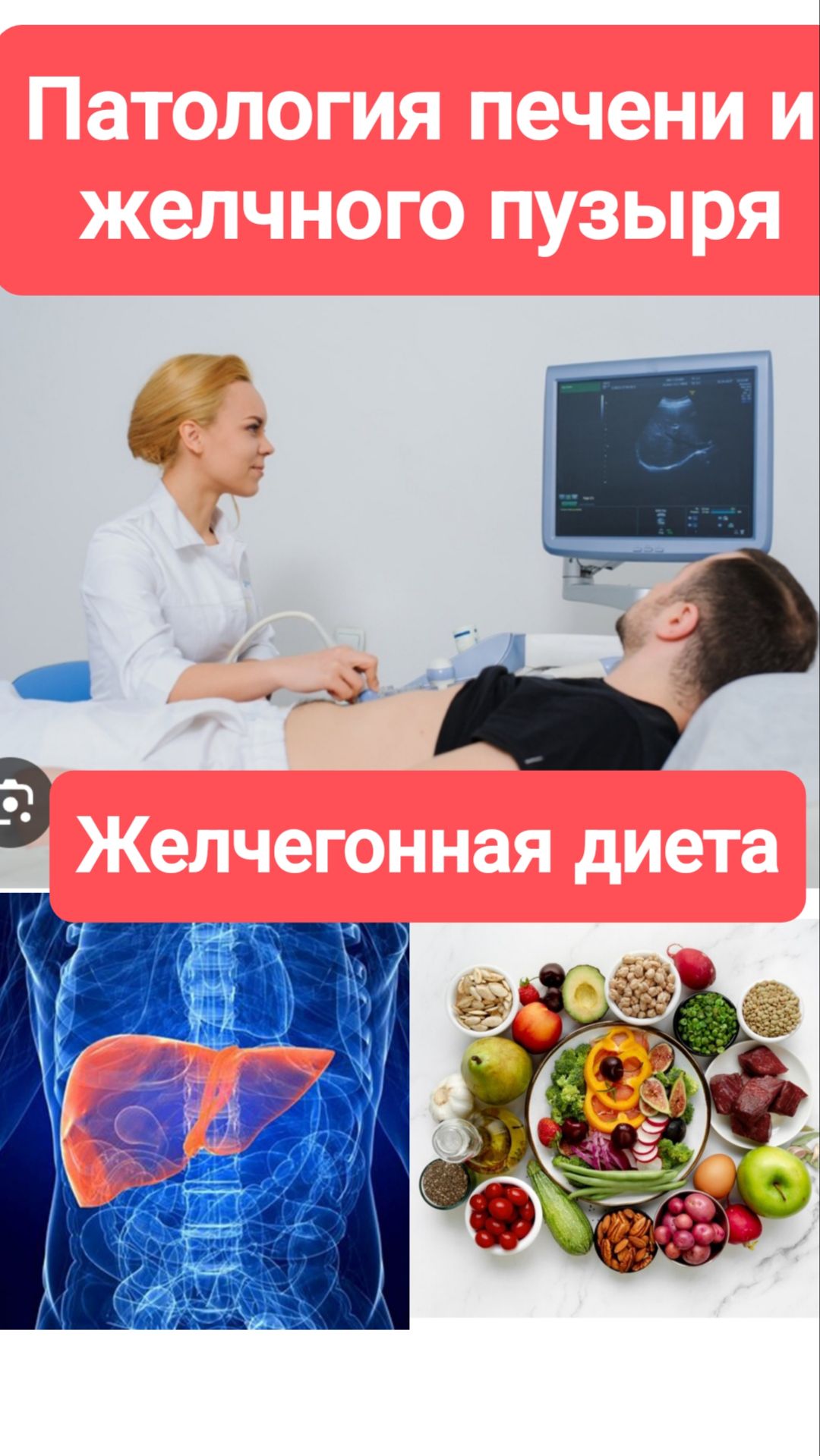 Патология печени и желчного пузыря. Принципы желчегонной диеты