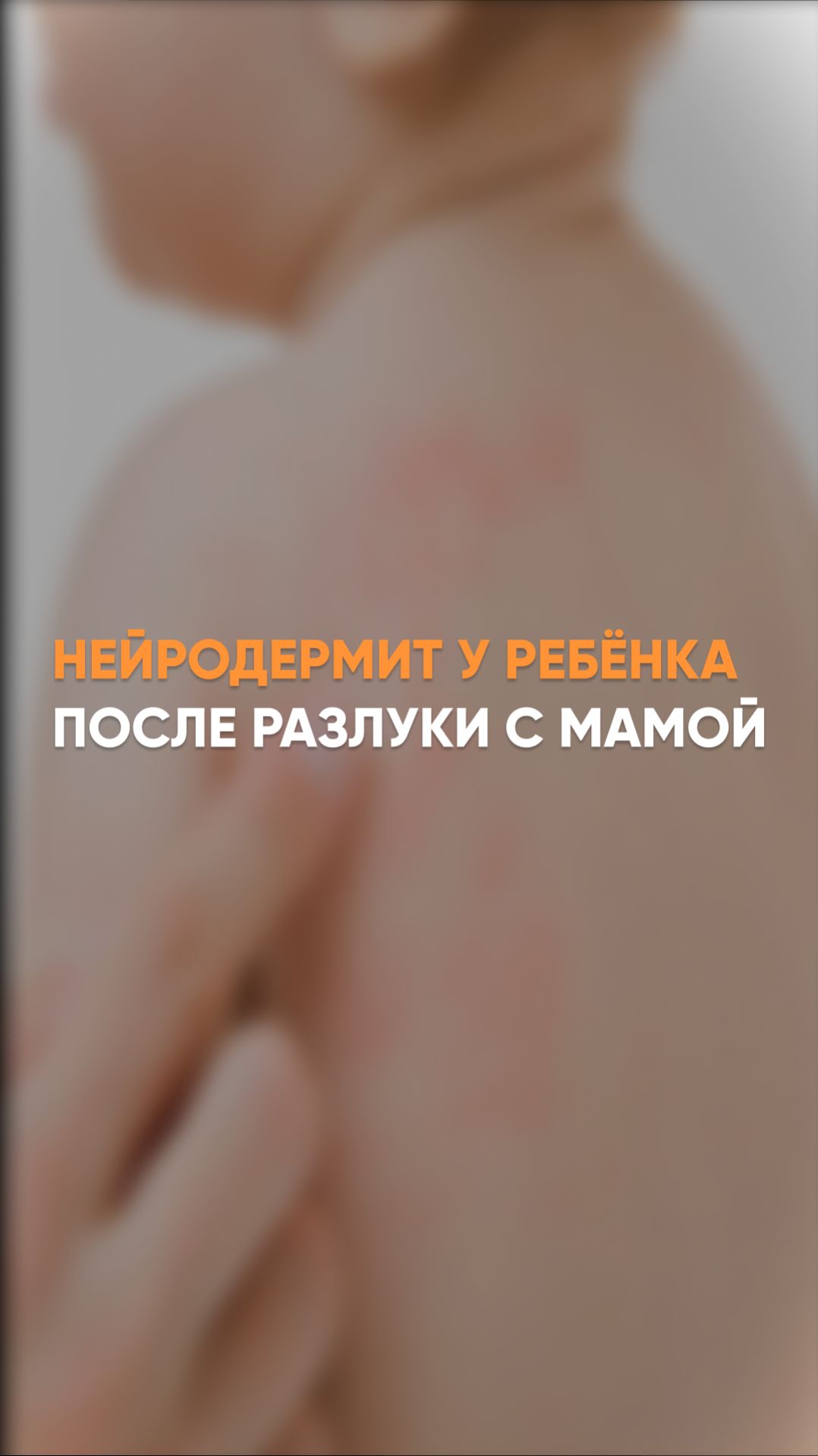 Нейродермит у ребёнка после разлуки с мамой