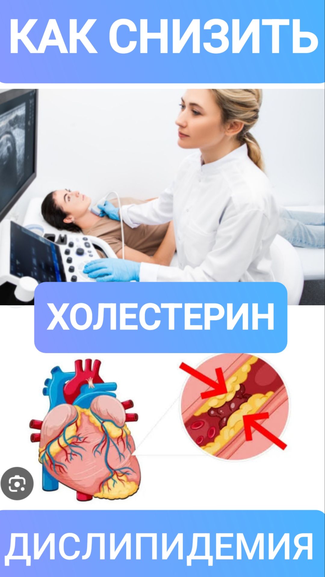 КАК СНИЗИТЬ УРОВЕНЬ ХОЛЕСТЕРИНА?