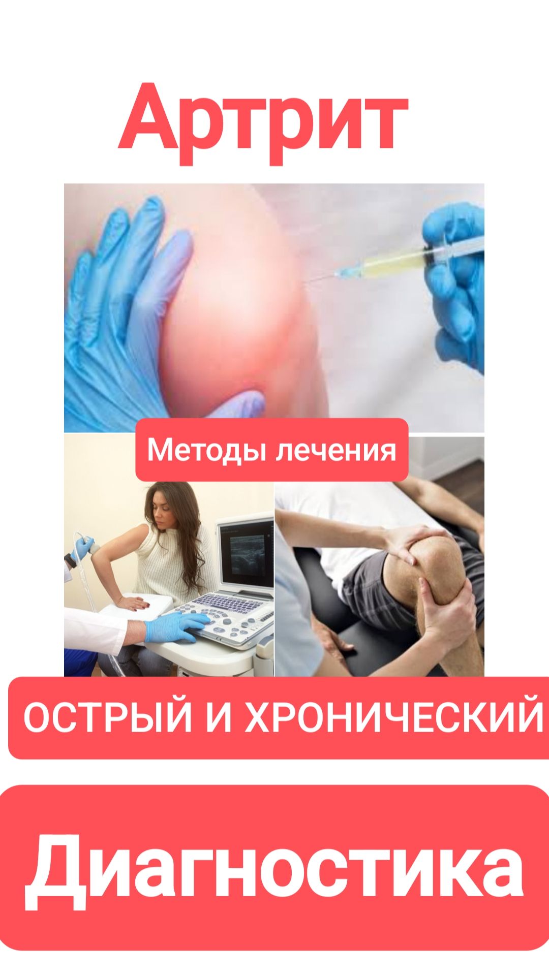 ОСТРЫЙ И ХРОНИЧЕСКИЙ АРТРИТ. Методы лечения