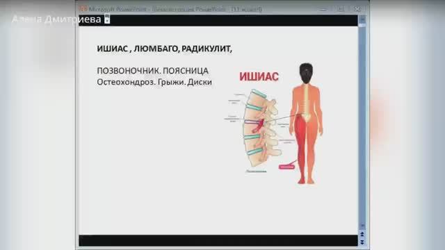 Про ишиас, люмбаго,радикулит. Алена Дмитриева.