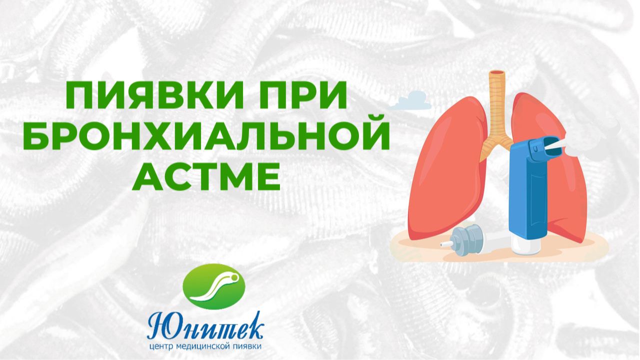 D0617a0851eb8037166b64ad5a2721e1