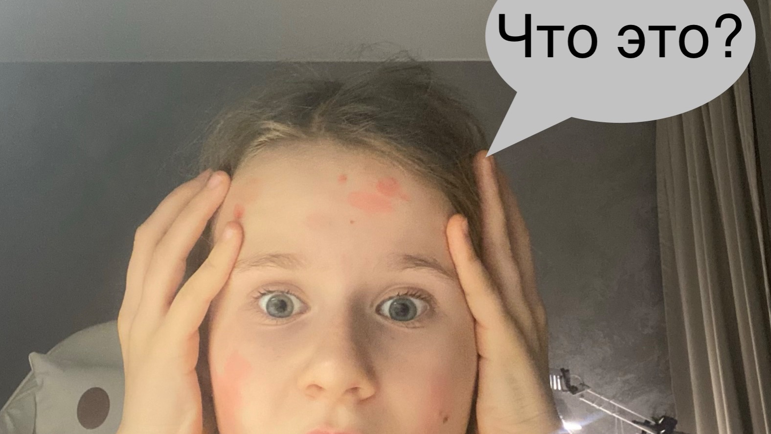 Собираемся в Москву у меня началась аллергия !!!!!