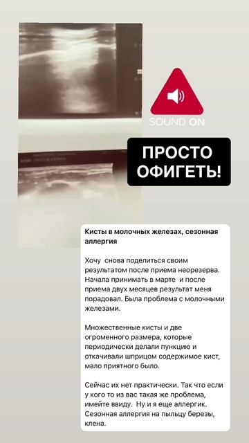 отзыв  NEORESERVO