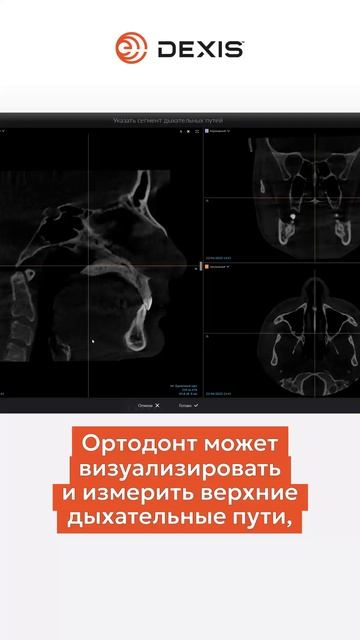 Автоматическая идентификация дыхательных путей. DTX Studio Clinic