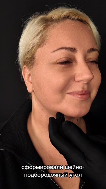 11 дней после комплексной операции: