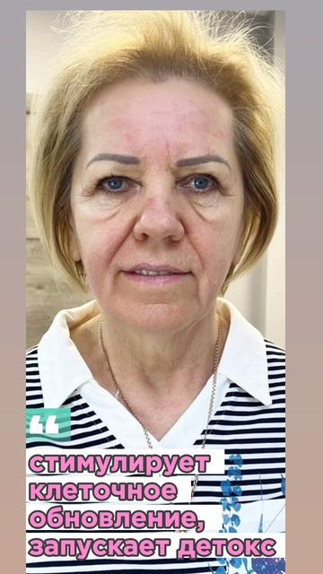 буккально-скульптурный.mp4