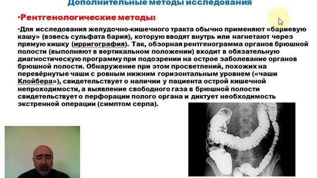 Лекция: Острые Хирургические заболевания брюшной полости Часть 1