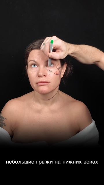 SMAS-подтяжкf