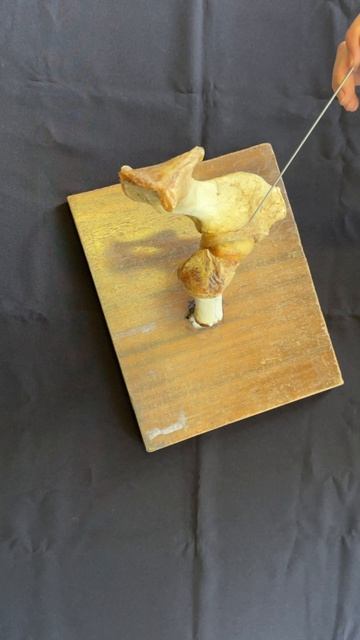 Строение тазобедренного сустава