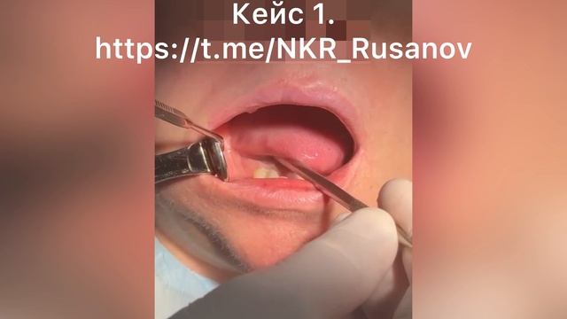 НКР 1.1.2 Операция