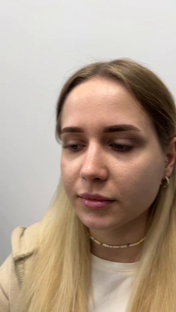 Ринопластика 1 год после операции