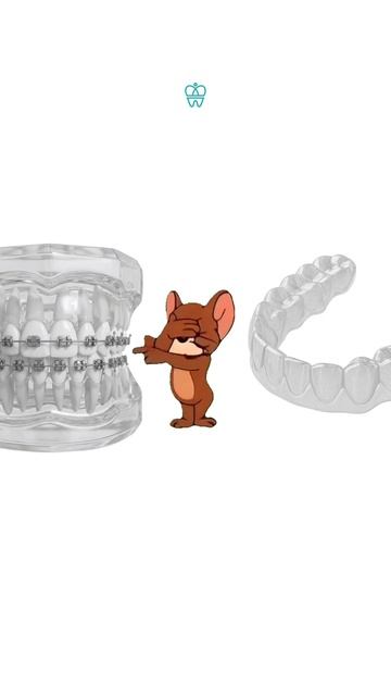 Брекеты или элайнеры — что выбрать? #стоматологиядоминанта #брекеты #элайнеры #зубы