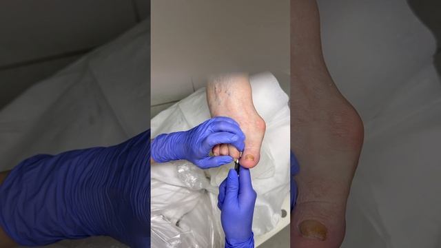 Обработка ногтей