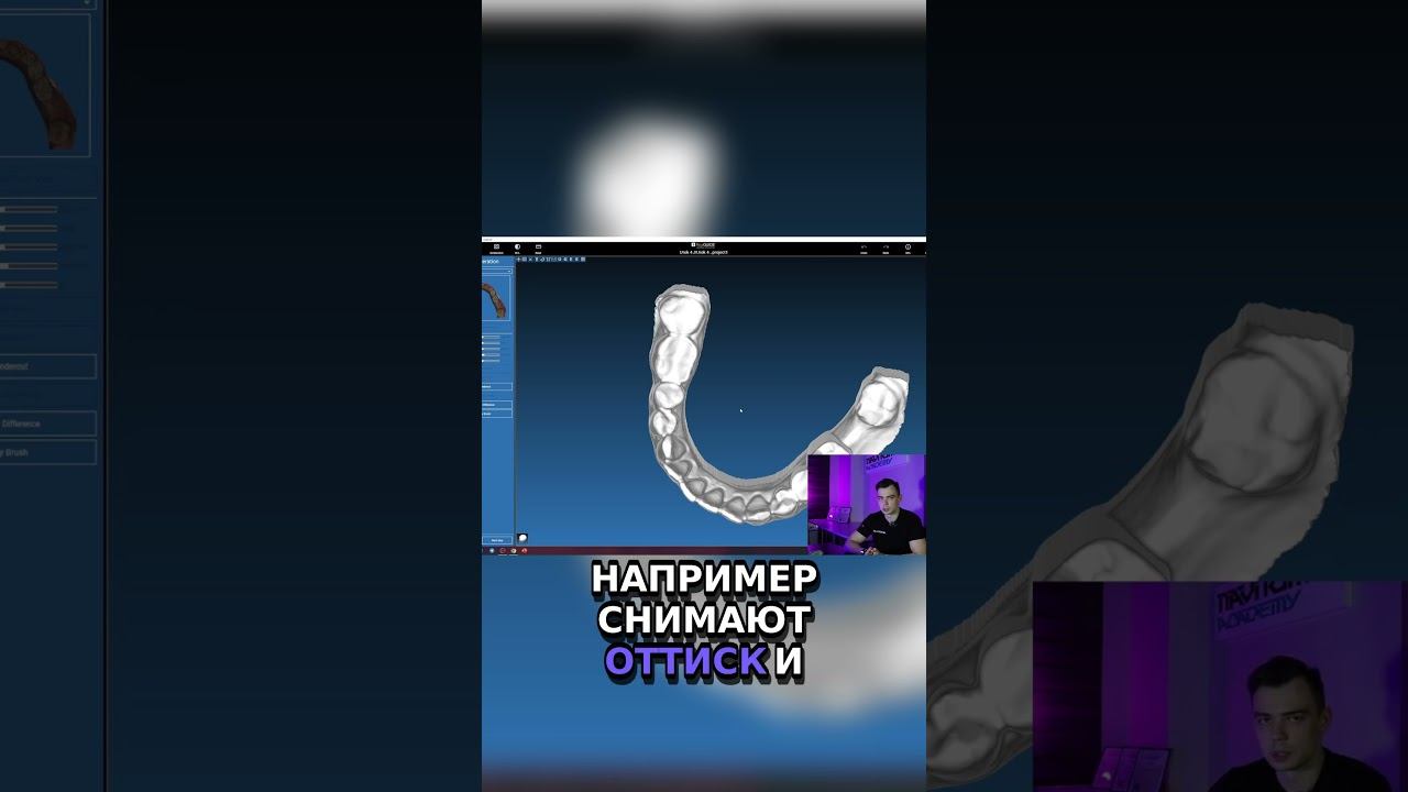Крик в пустоту  Ошибки, которые нельзя игнорировать в стоматологии