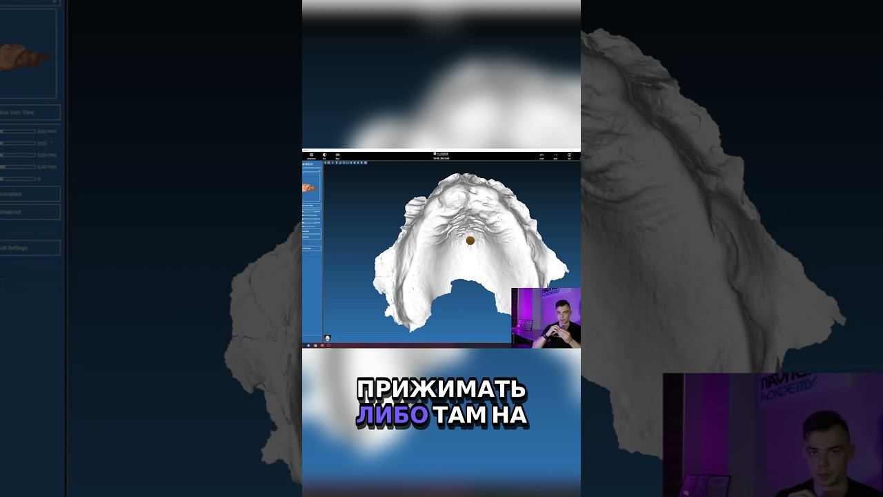 Как удержать хирургический шаблон  Советы и лайфхаки!